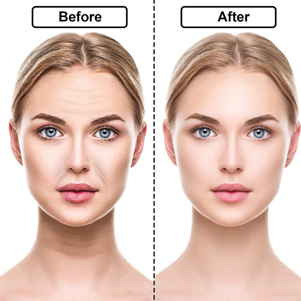 Reusable Silicone Wrinkle Removal