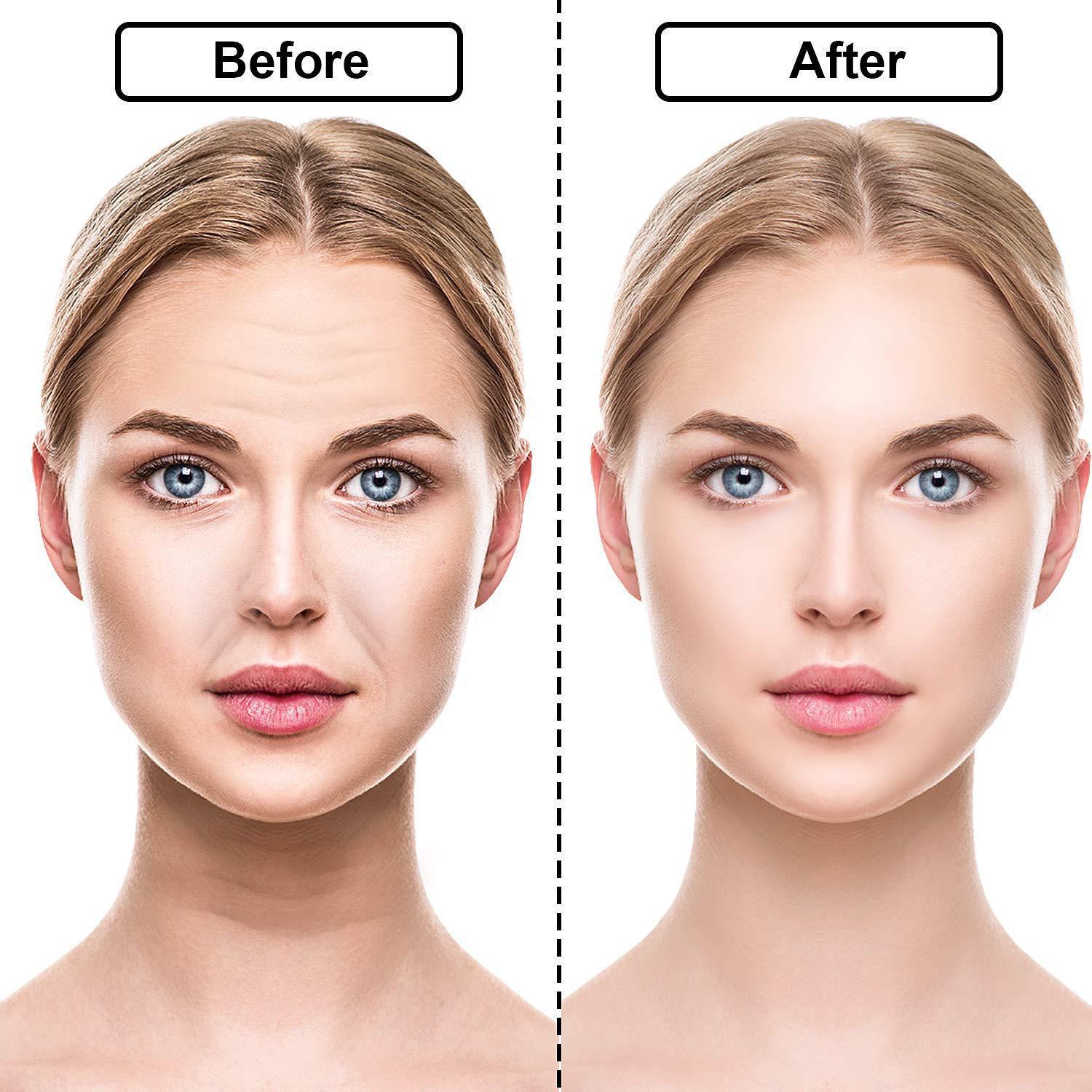 Reusable Silicone Wrinkle Removal